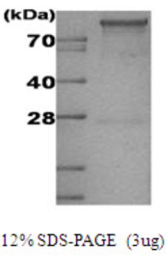 SDS-PAGE (HK1-1141H).jpg